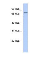ZNF45 Antibody - ZNF45 antibody Western blot of Transfected 293T cell lysate. This image was taken for the unconjugated form of this product. Other forms have not been tested.