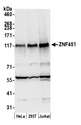 ZNF451 Antibody - Detection of human ZNF451 by western blot. Samples: Whole cell lysate (50 µg) from HeLa, HEK293T, and Jurkat cells prepared using NETN lysis buffer. Antibody: Affinity purified rabbit anti-ZNF451 antibody used for WB at 0.1 µg/ml. Detection: Chemiluminescence with an exposure time of 30 seconds.