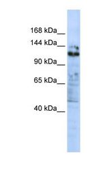 ZNF451 Antibody - MCF7 cell lysate. Antibody concentration: 1.0 ug/ml. Gel concentration: 6-18%.  This image was taken for the unconjugated form of this product. Other forms have not been tested.
