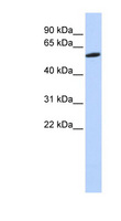 ZNF454 Antibody - ZNF454 antibody Western blot of HeLa lysate. This image was taken for the unconjugated form of this product. Other forms have not been tested.