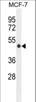 ZNF454 Antibody - ZNF454 Antibody western blot of MCF-7 cell line lysates (35 ug/lane). The ZNF454 antibody detected the ZNF454 protein (arrow).