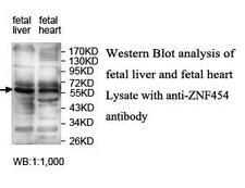 ZNF454 Antibody