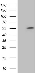 ZNF454 Antibody - HEK293T cells were transfected with the pCMV6-ENTRY control. (Left lane) or pCMV6-ENTRY ZNF454. (Right lane) cDNA for 48 hrs and lysed. Equivalent amounts of cell lysates. (5 ug per lane) were separated by SDS-PAGE and immunoblotted with anti-ZNF454. (1:2000)