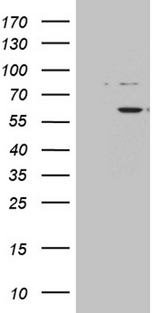 ZNF454 Antibody - HEK293T cells were transfected with the pCMV6-ENTRY control. (Left lane) or pCMV6-ENTRY ZNF454. (Right lane) cDNA for 48 hrs and lysed