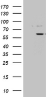 ZNF454 Antibody - HEK293T cells were transfected with the pCMV6-ENTRY control. (Left lane) or pCMV6-ENTRY ZNF454. (Right lane) cDNA for 48 hrs and lysed