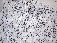 ZNF454 Antibody - Immunohistochemical staining of paraffin-embedded Human thyroid tissue within the normal limits using anti-ZNF454 mouse monoclonal antibody. (Heat-induced epitope retrieval by 1mM EDTA in 10mM Tris buffer. (pH8.5) at 120°C for 3 min. (1:150)