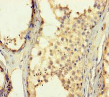 ZNF454 Antibody - Immunohistochemistry of paraffin-embedded human testis tissue using ZNF454 Antibody at dilution of 1:100