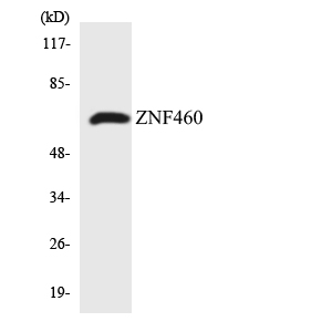 ZNF460 Antibody - Western blot analysis of the lysates from HepG2 cells using ZNF460 antibody.