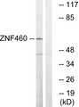 ZNF460 Antibody - Western blot analysis of lysates from LOVO cells, using ZNF460 Antibody. The lane on the right is blocked with the synthesized peptide.