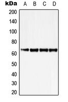 ZNF460 Antibody - Western blot analysis of ZNF460 expression in K562 (A); Jurkat (B); SP2/0 (C); H9C2 (D) whole cell lysates.