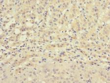 ZNF462 Antibody - Immunohistochemistry of paraffin-embedded human adrenal gland tissue using ZNF462 Antibody at dilution of 1:100