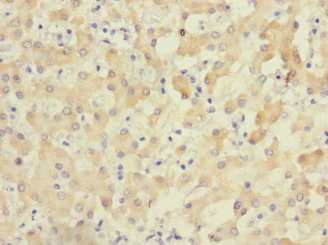 ZNF462 Antibody - Immunohistochemistry of paraffin-embedded human liver tissue using ZNF462 Antibody at dilution of 1:100