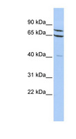 ZNF471 Antibody - ZNF471 antibody Western blot of HepG2 cell lysate. This image was taken for the unconjugated form of this product. Other forms have not been tested.