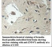 ZNF471 Antibody