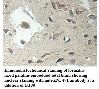 ZNF471 Antibody