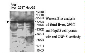 ZNF471 Antibody