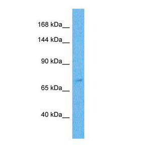 ZNF471 Antibody - Western blot of Human Thyroid Tumor. ZNF471 antibody dilution 1.0 ug/ml.  This image was taken for the unconjugated form of this product. Other forms have not been tested.