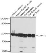 ZNF471 Antibody - Western blot analysis of extracts of various cell lines using ZNF471 Polyclonal Antibody at dilution of 1:1000.