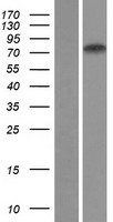 ZNF471 Protein - Western validation with an anti-DDK antibody * L: Control HEK293 lysate R: Over-expression lysate