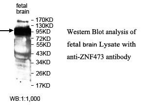 ZNF473 Antibody