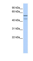 ZNF474 Antibody - ZNF474 antibody Western blot of Fetal Brain lysate. This image was taken for the unconjugated form of this product. Other forms have not been tested.