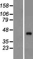 ZNF474 Protein - Western validation with an anti-DDK antibody * L: Control HEK293 lysate R: Over-expression lysate