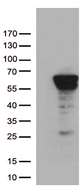 ZNF480 Antibody - HEK293T cells were transfected with the pCMV6-ENTRY control. (Left lane) or pCMV6-ENTRY ZNF480. (Right lane) cDNA for 48 hrs and lysed. Equivalent amounts of cell lysates. (5 ug per lane) were separated by SDS-PAGE and immunoblotted with anti-ZNF480. (1:500)