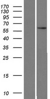 ZNF480 Protein - Western validation with an anti-DDK antibody * L: Control HEK293 lysate R: Over-expression lysate