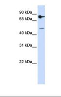 ZNF483 Antibody - MCF7 cell lysate. Antibody concentration: 1.0 ug/ml. Gel concentration: 12%.  This image was taken for the unconjugated form of this product. Other forms have not been tested.