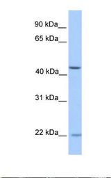 ZNF485 Antibody - Fetal liver lysate. Antibody concentration: 1.0 ug/ml. Gel concentration: 12%.  This image was taken for the unconjugated form of this product. Other forms have not been tested.