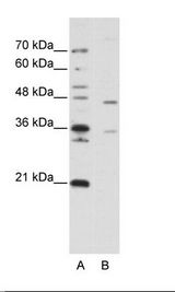 ZNF488 Antibody - A: Marker, B: Jurkat Cell Lysate.  This image was taken for the unconjugated form of this product. Other forms have not been tested.