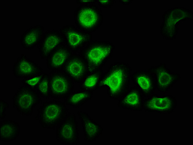 ZNF488 Antibody - Immunofluorescence staining of A549 cells with ZNF488 Antibody at 1:166, counter-stained with DAPI. The cells were fixed in 4% formaldehyde, permeabilized using 0.2% Triton X-100 and blocked in 10% normal Goat Serum. The cells were then incubated with the antibody overnight at 4°C. The secondary antibody was Alexa Fluor 488-congugated AffiniPure Goat Anti-Rabbit IgG(H+L).