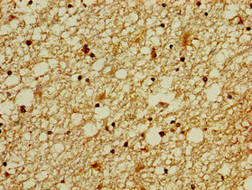 ZNF488 Antibody - Immunohistochemistry of paraffin-embedded human brain tissue using ZNF488 Antibody at dilution of 1:100