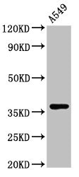 ZNF488 Antibody - Western Blot Positive WB detected in: A549 whole cell lysate All lanes: ZNF488 antibody at 3.4µg/ml Secondary Goat polyclonal to rabbit IgG at 1/50000 dilution Predicted band size: 37, 26 kDa Observed band size: 37 kDa