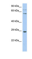 ZNF490 Antibody - ZNF490 antibody Western blot of OVCAR-3 cell lysate. This image was taken for the unconjugated form of this product. Other forms have not been tested.