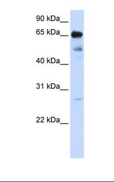 ZNF490 Antibody - 721_B cell lysate. Antibody concentration: 1.0 ug/ml. Gel concentration: 12%.  This image was taken for the unconjugated form of this product. Other forms have not been tested.