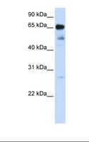 ZNF490 Antibody - 721_B cell lysate. Antibody concentration: 1.0 ug/ml. Gel concentration: 12%.  This image was taken for the unconjugated form of this product. Other forms have not been tested.