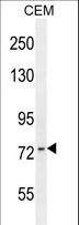 ZNF493 Antibody - ZNF493 Antibody western blot of CEM cell line lysates (35 ug/lane). The ZNF493 antibody detected the ZNF493 protein (arrow).