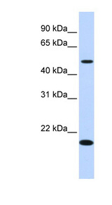ZNF493 Antibody - ZNF493 antibody Western blot of Fetal Liver lysate.