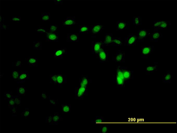 ZNF496 / NZIP1 Antibody - Immunofluorescence of monoclonal antibody to ZNF496 on NIH/3T3 cell. [antibody concentration 10 ug/ml]