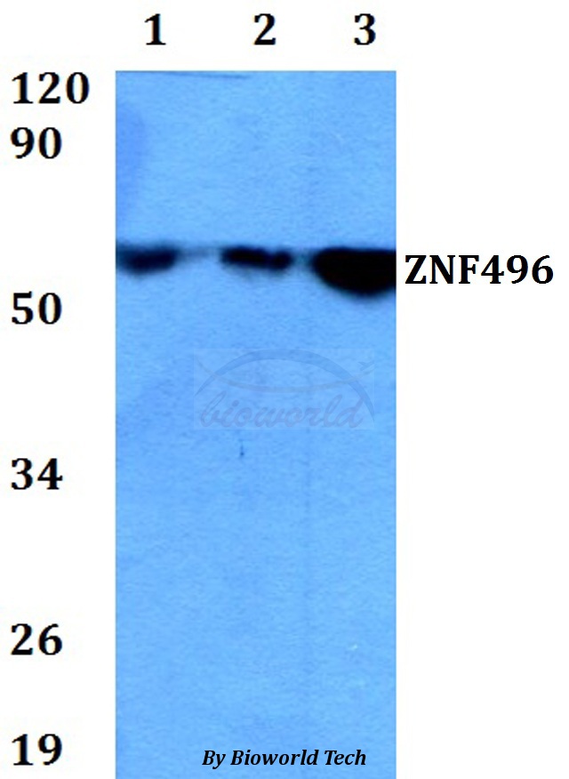 ZNF496 / NZIP1 Antibody - Western blot of ZNF496 antibody at 1:500 dilution. Lane 1: HEK293T whole cell lysate. Lane 2: Raw264.7 whole cell lysate. Lane 3: PC12 whole cell lysate.