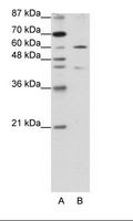 ZNF496 / NZIP1 Antibody - A: Marker, B: HepG2 Cell Lysate.  This image was taken for the unconjugated form of this product. Other forms have not been tested.