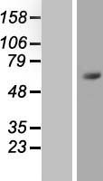 ZNF496 / NZIP1 Protein - Western validation with an anti-DDK antibody * L: Control HEK293 lysate R: Over-expression lysate
