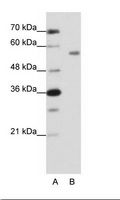 ZNF497 Antibody - A: Marker, B: HepG2 Cell Lysate.  This image was taken for the unconjugated form of this product. Other forms have not been tested.