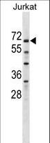 ZNF498 Antibody - ZNF498 Antibody western blot of Jurkat cell line lysates (35 ug/lane). The ZNF498 antibody detected the ZNF498 protein (arrow).