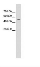 ZNF498 Antibody - Jurkat Cell Lysate.  This image was taken for the unconjugated form of this product. Other forms have not been tested.