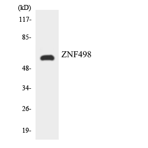 ZNF498 Antibody - Western blot analysis of the lysates from HUVECcells using ZNF498 antibody.