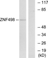ZNF498 Antibody - Western blot analysis of lysates from COS7 cells, using ZNF498 Antibody. The lane on the right is blocked with the synthesized peptide.