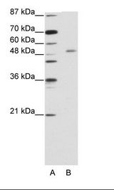 ZNF498 Antibody - A: Marker, B: Jurkat Cell Lysate.  This image was taken for the unconjugated form of this product. Other forms have not been tested.