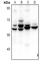 ZNF498 Antibody - Western blot analysis of ZNF498 expression in HepG2 (A), HCT116 (B), MEF (C), H9C2 (D) whole cell lysates.